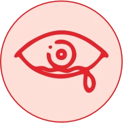 Soothes Red, Watery Eyes