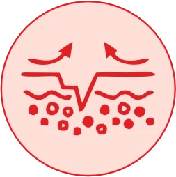 Supports Skin & Lesion Recovery 